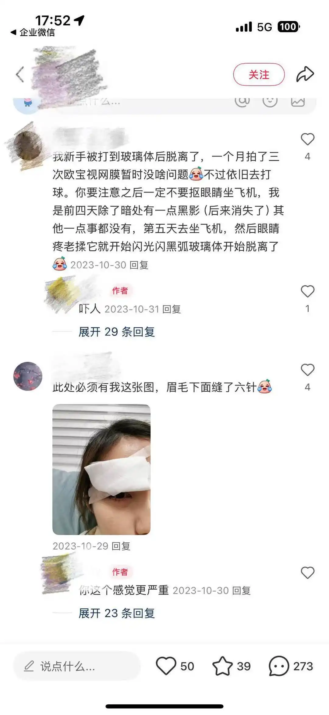和天然球非, 黄夕寅, 球的人造球